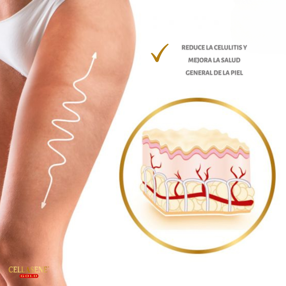 Pack X 6 Cellasene Gold Celulitis - Avanzada E Incrustada - (atacar) Tratamiento De 3 Meses