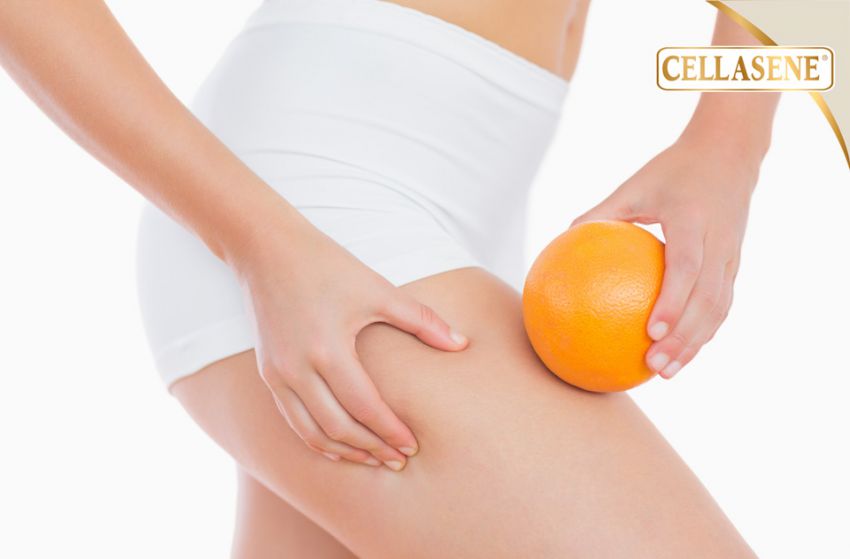 Celulitis: Tratamientos y recomendaciones