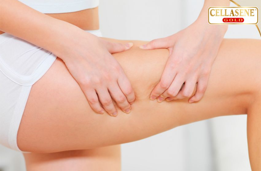 ¿Porqué la celulitis es una enfermedad?