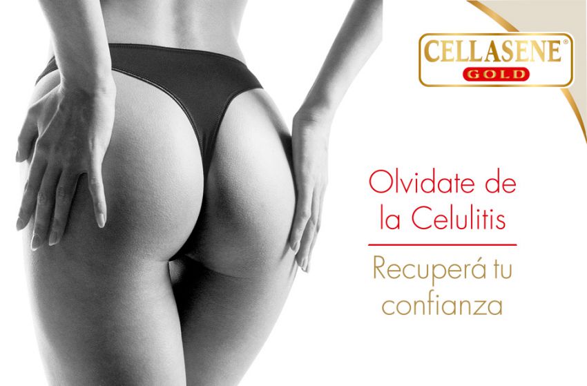 ¿Sabés qué tipo de celulitis tenés?